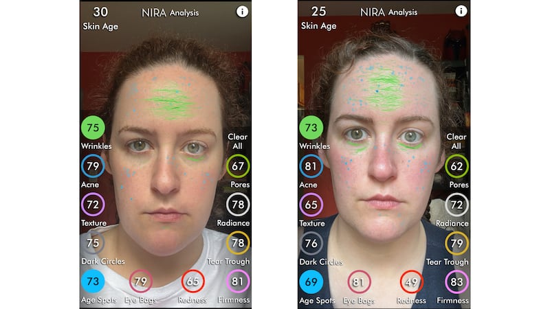 Two photos of the author's face, marked up with colorful lines and dots to indicate imperfections. The left is a before image, the right is an after. The changes are subtle.