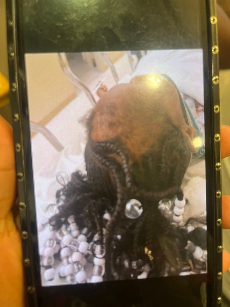 A photo displayed on a smartphone screen shows a child with braided hair and visible alopecia.