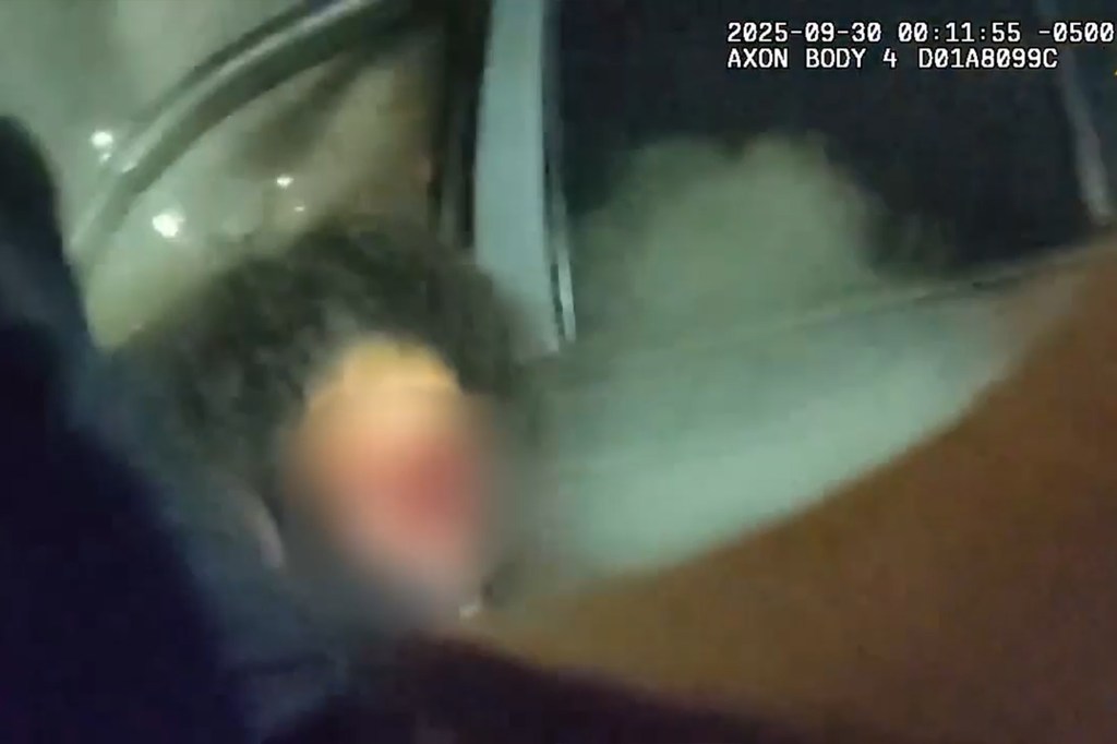 The woman, who was charged with driving under the influence, injured her leg in the crash.