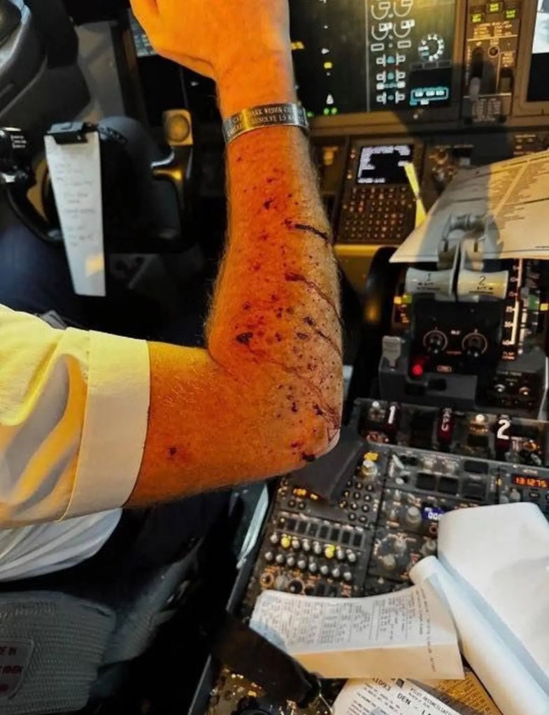 Pilot's arm covered in cuts and blood, next to a cockpit control panel.