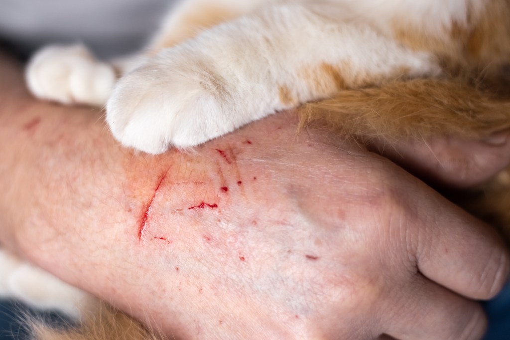 A cat's white and orange paw resting on a person's hand, which has multiple red scratches from the cat's claws.