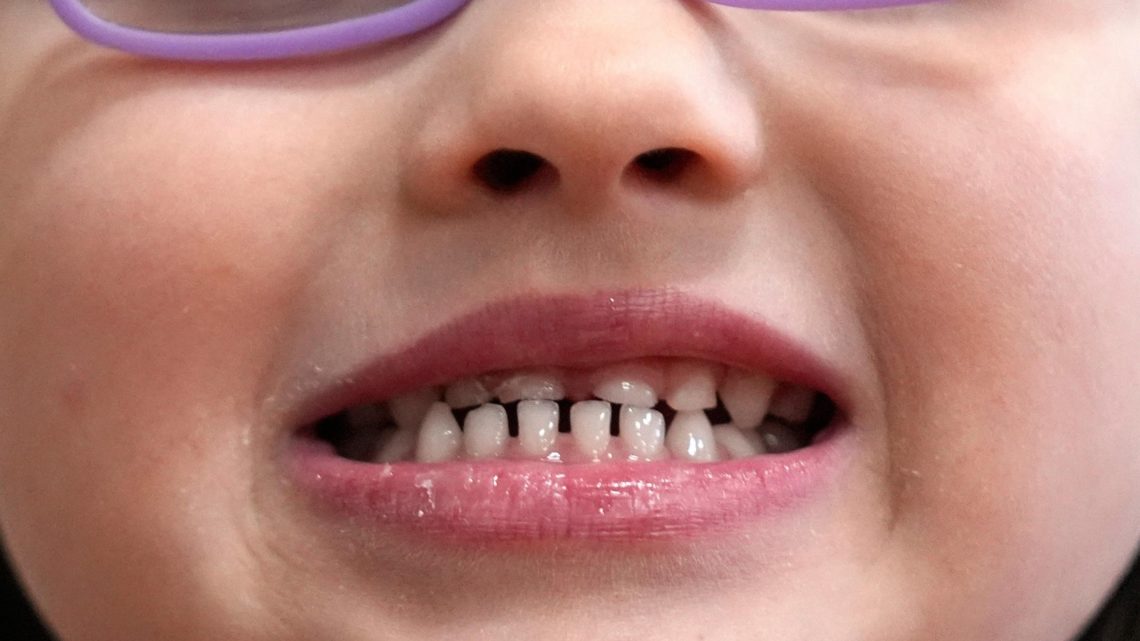 FDA restricts use of kids’ fluoride supplements, citing emerging health risks