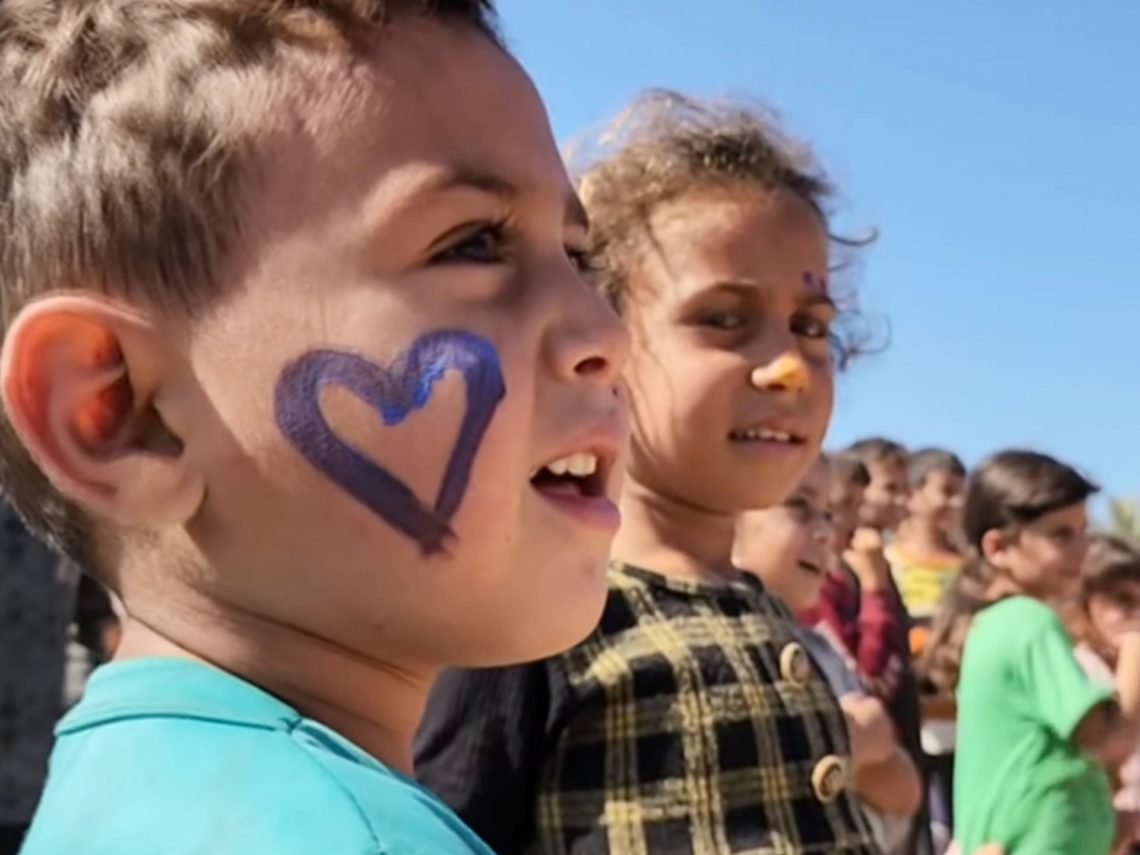 Acute trauma: The ever-present wounds of Gaza’s children from Israel’s war