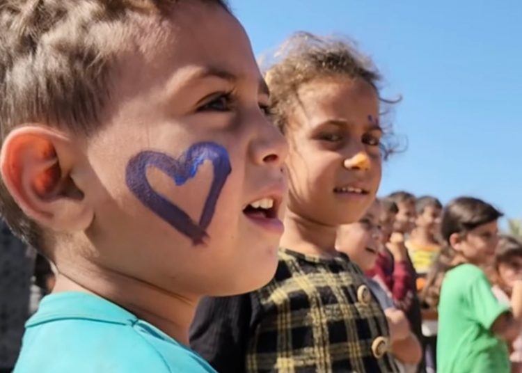 Acute trauma: The ever-present wounds of Gaza’s children from Israel’s war