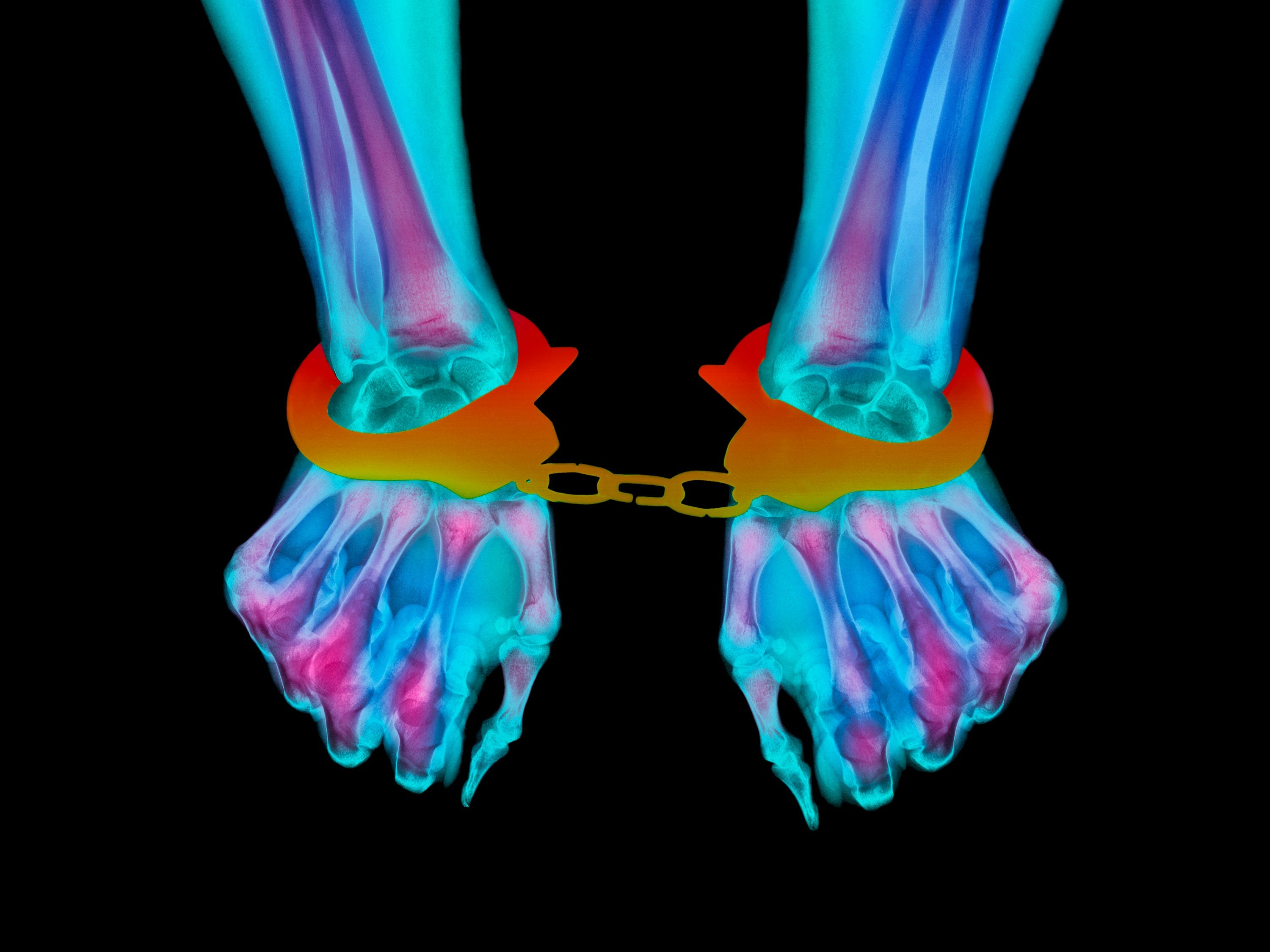 An x-ray of a person with handcuffs on
