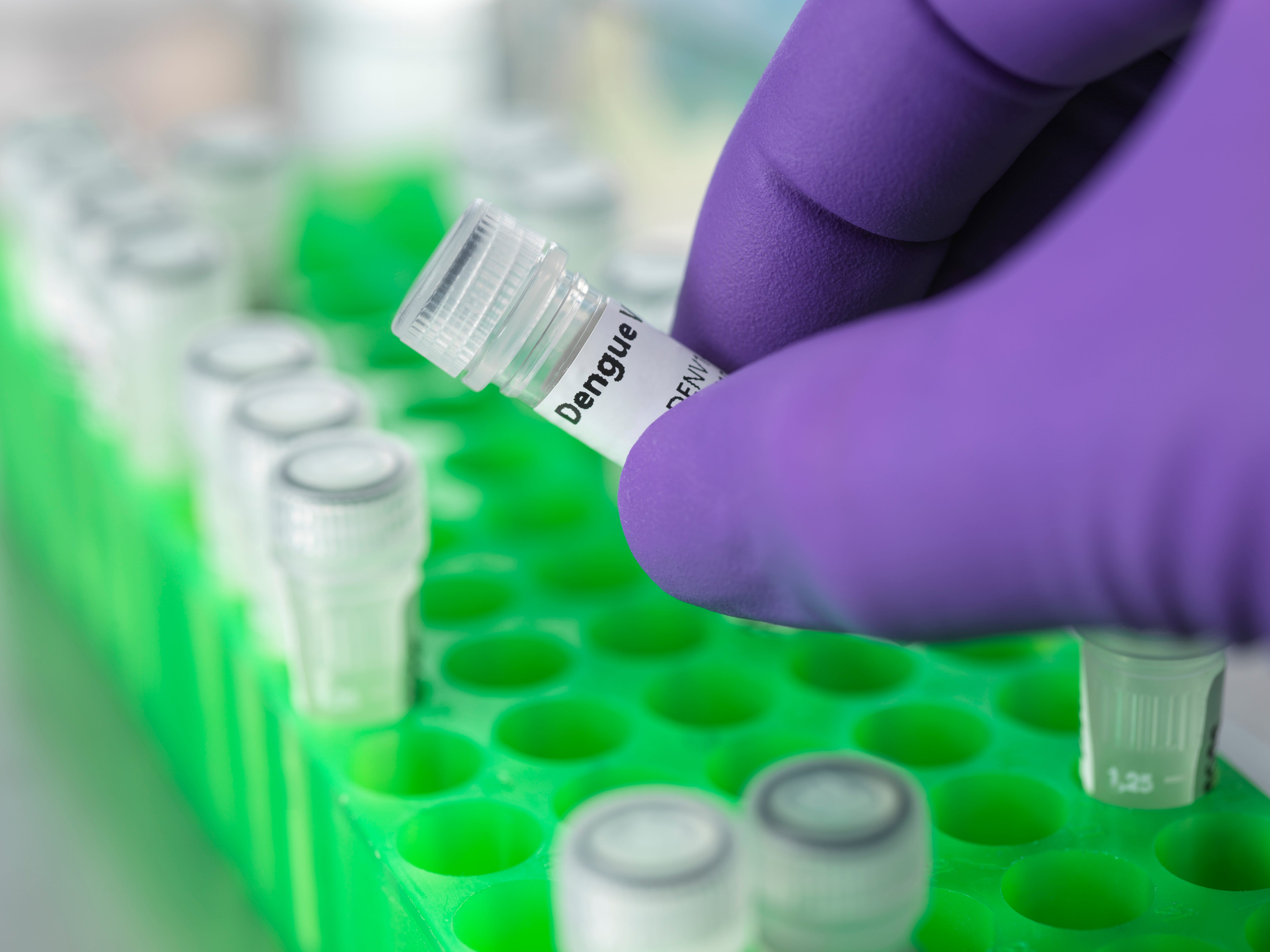 A scientist holds a vial containing an antigen for the dengue virus.