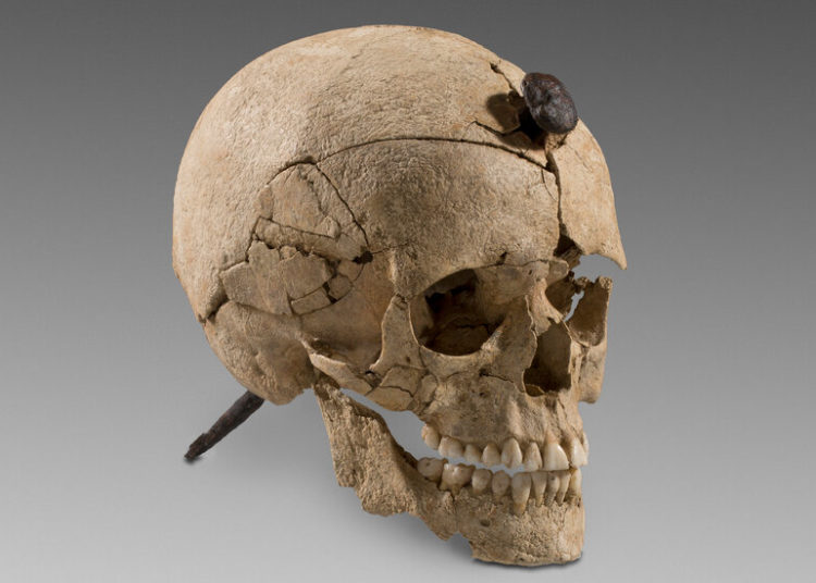 In Ancient Spain, a Nail Through the Skull Could Mean Enmity, or Honor