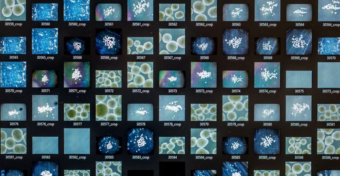 The challenge of creating brains in a lab