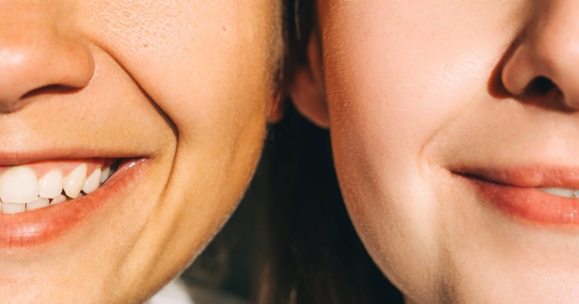 Why I Lie About Getting Plastic Surgery