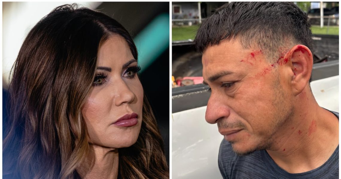 Judge Blasts ICE’s ‘Fictional’ Attempt to Jail Man for 20 Years Over Goon’s Self-Inflicted Injury