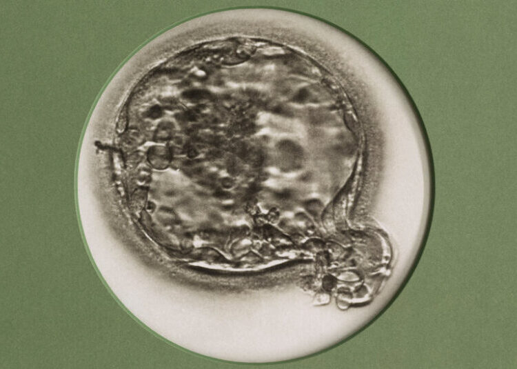 Want People to Have More Babies? Make I.V.F. Easier to Get.