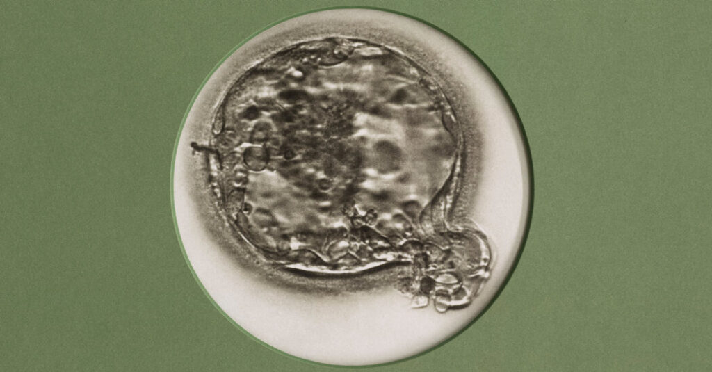 Want People to Have More Babies? Make I.V.F. Easier to Get.