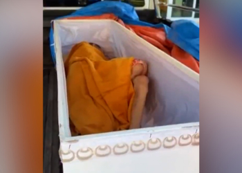 A Woman Was Seconds From Cremation When Someone Realized She Was Still Alive