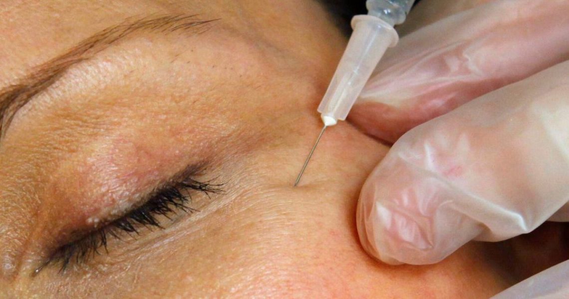 FDA warns websites selling unapproved Botox for cosmetic purposes