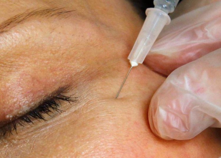 FDA warns websites selling unapproved Botox for cosmetic purposes