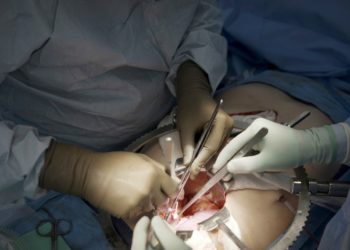 First clinical trial of pig kidney transplants gets underway