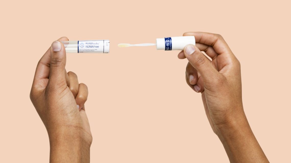 Gut microbiome tests are everywhere. Should you get one?