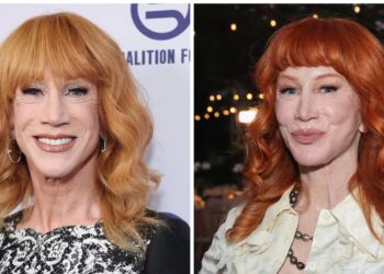 Kathy Griffin, 65, Says Third Facelift Came at a Shocking Price