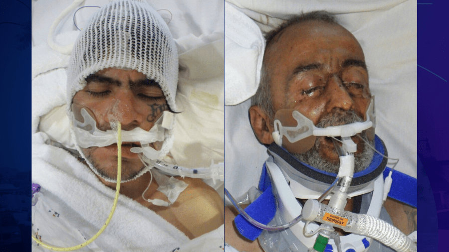 Los Angeles hospital seeks help identifying 2 injured patients