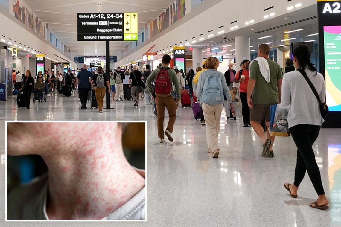 NJ issues health warning after passenger with measles travels through Newark airport