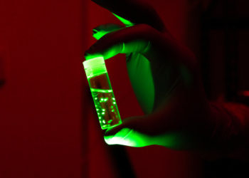 What We Can Learn From Brain Organoids