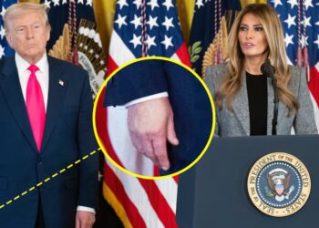 Trump, 79, Wears Hand Makeup for Melania Speech