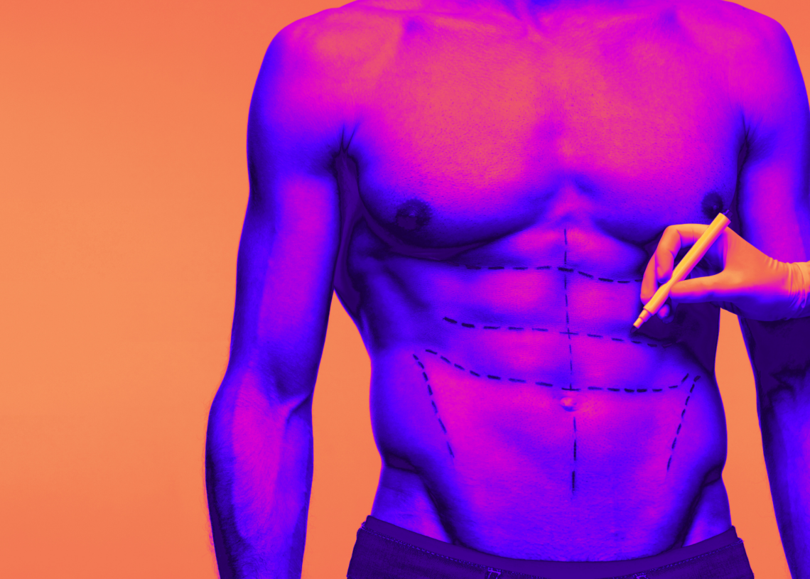 Man Injects Himself With $560,000 Worth of Fillers for Fake 8-Pack Abs