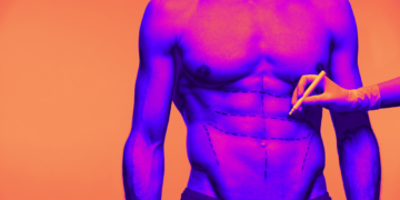 Man Injects Himself With $560,000 Worth of Fillers for Fake 8-Pack Abs