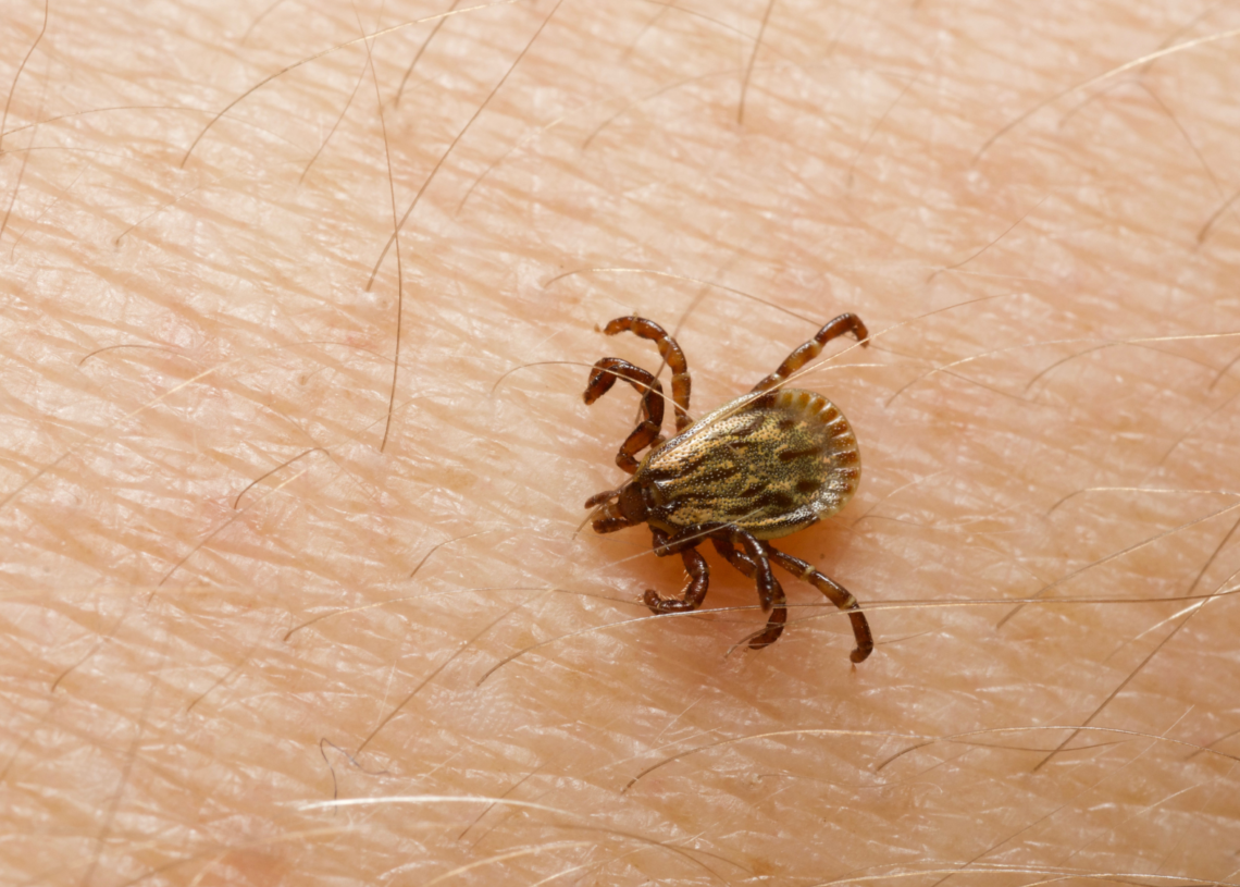 This Tick-Induced Meat Allergy May Have Just Claimed Its First Life