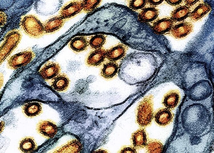 Washington state resident dies of new H5N5 form of bird flu