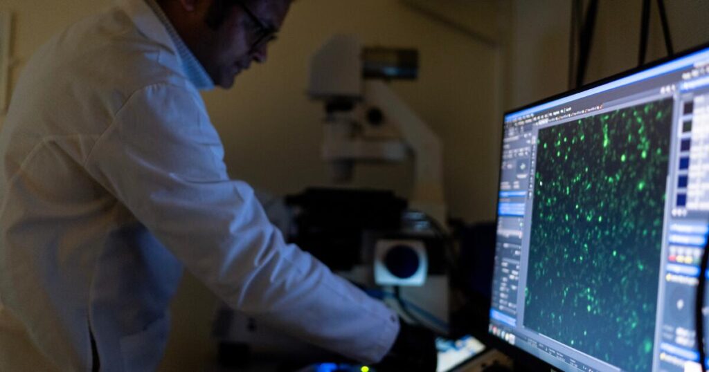 There are more than 100 autoimmune diseases, and they mostly strike women. Here’s what to know