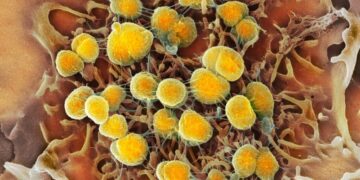 F.D.A. Approves Two New Drugs to Treat Gonorrhea