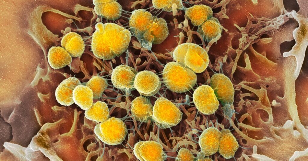 F.D.A. Approves Two New Drugs to Treat Gonorrhea