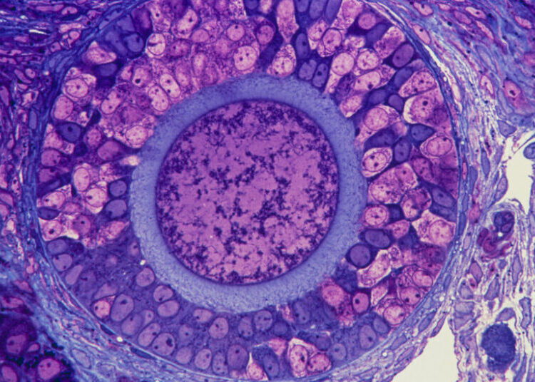 Doctors Think Ovaries, Not Just Eggs, Are Factors in Fertility and Aging