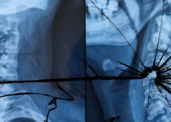 Don’t Fear Self-Driving Cars. They Save Lives.