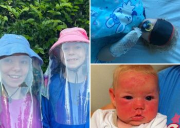 Summer sun is life-threatening for sisters with rare genetic disorder