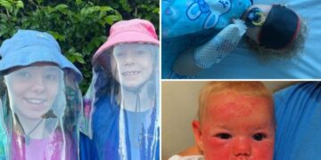 Summer sun is life-threatening for sisters with rare genetic disorder