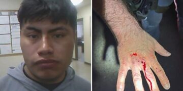 Illegal immigrant bites ICE officer, draws blood while resisting arrest in Louisiana: DHS