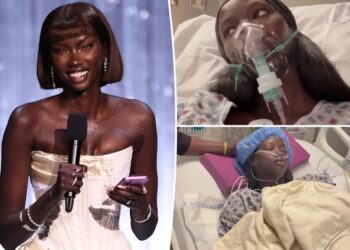 Supermodel Anok Yai, 28, diagnosed with congenital defect that’s ‘destroying’ her lungs