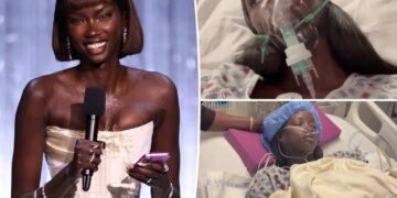 Supermodel Anok Yai, 28, diagnosed with congenital defect that’s ‘destroying’ her lungs
