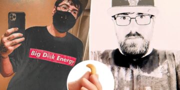 I have the world’s smallest penis — here’s how it impacts dating and sex