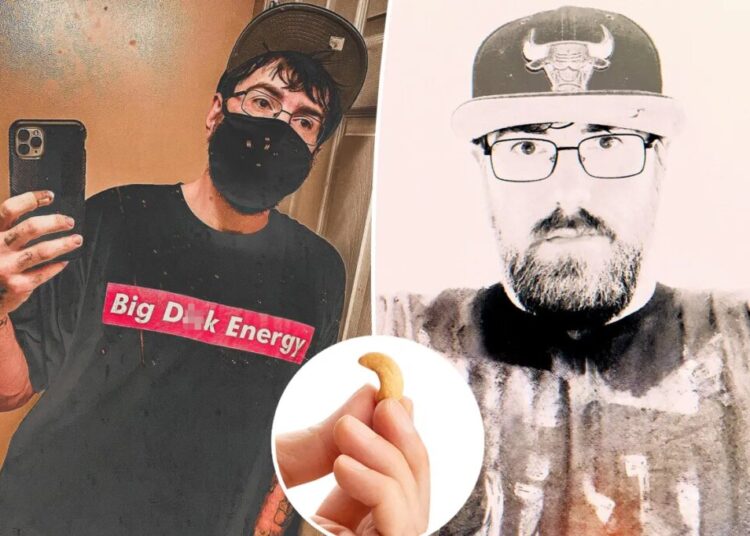 I have the world’s smallest penis — here’s how it impacts dating and sex