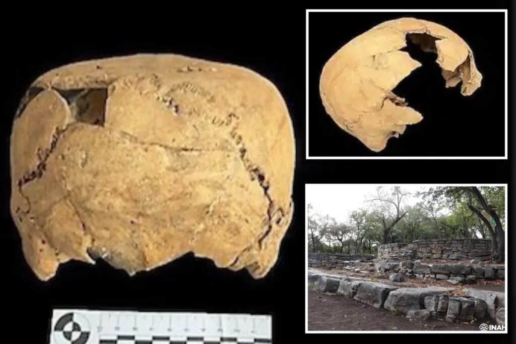1,400-year-old skull with mysterious flat top found in ancient village, startling archaeologists