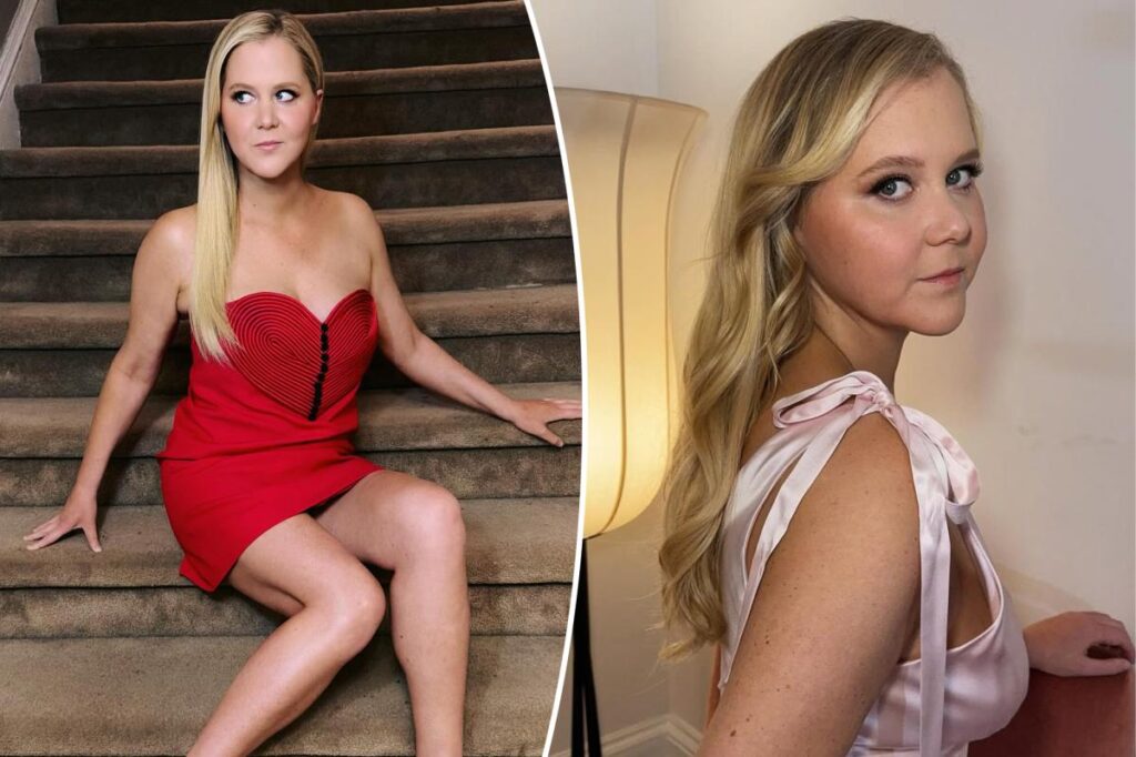 Amy Schumer sets the record straight on losing 50 pounds to ‘survive’ disease — not to ‘look hot’