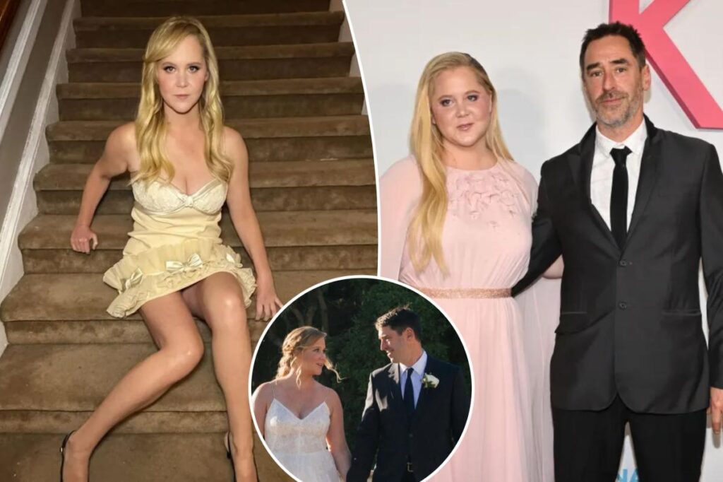 Amy Schumer working out ‘conscious uncoupling plan’ with husband: sources