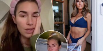 Jessie James Decker battles bizarre illness with facial swelling and respiratory issues