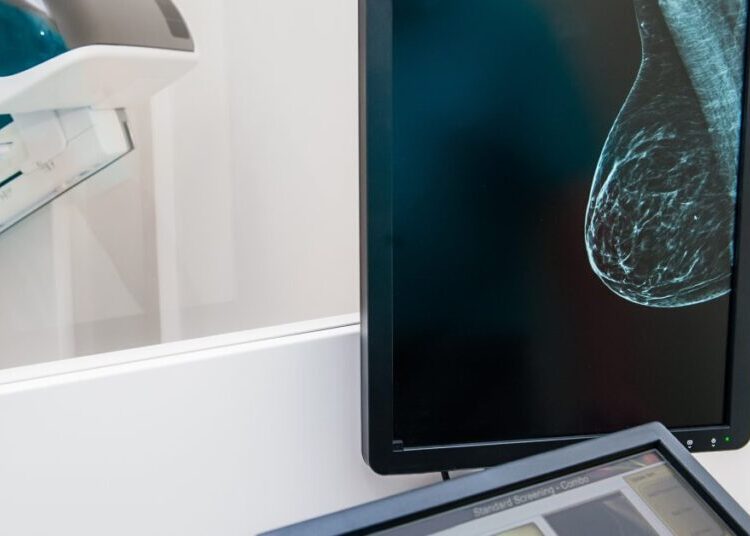 A New Study Challenges the Way We Screen for Breast Cancer