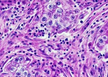 Doctors Catch Cancer-Diagnosing AI Extracting Patients’ Race Data and Being Racist With It