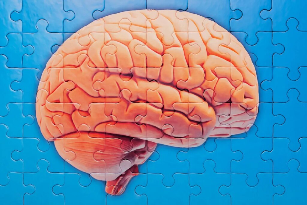 Scientists Identify Possible Game Changing Treatment for Alzheimer’s Disease That Could Control It Like High Cholesterol