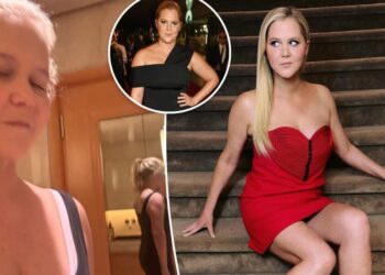 Amy Schumer shows off 50-pound weight loss in Skims selfie